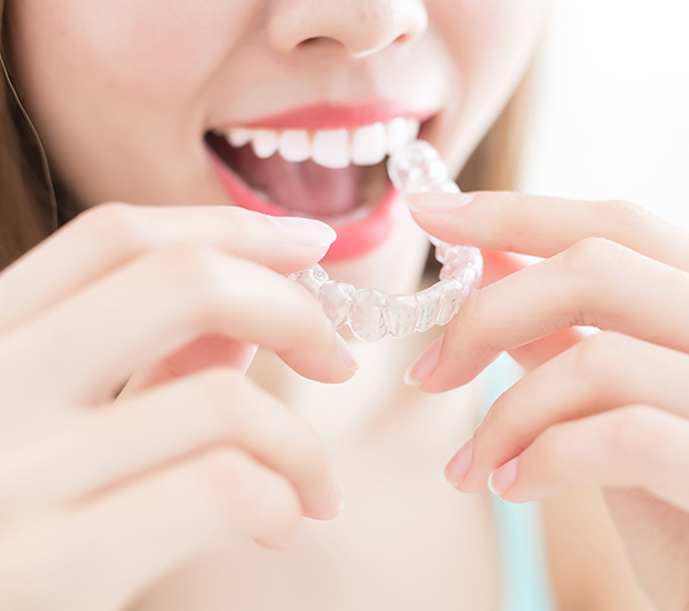 La Mesa Alternative to Braces for Teens