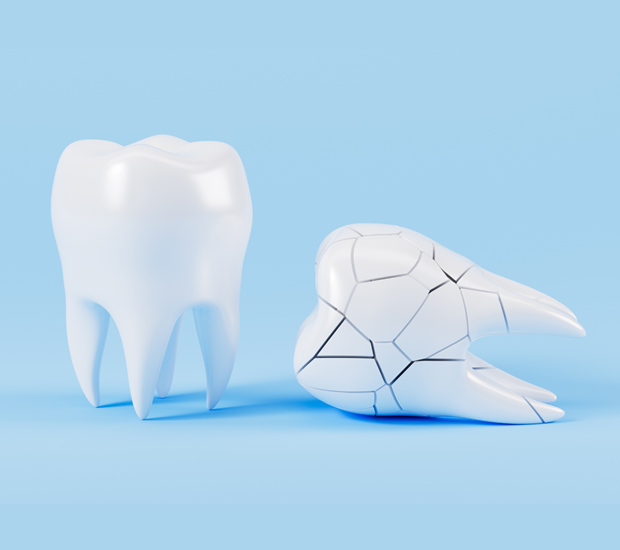 La Mesa What Should I Do If I Chip My Tooth