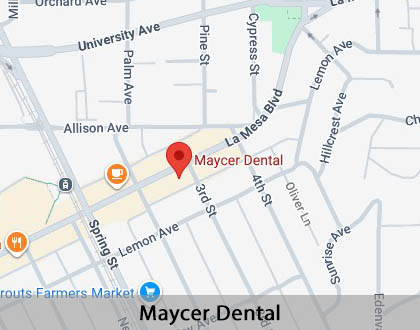 Map image for Invisalign in La Mesa, CA